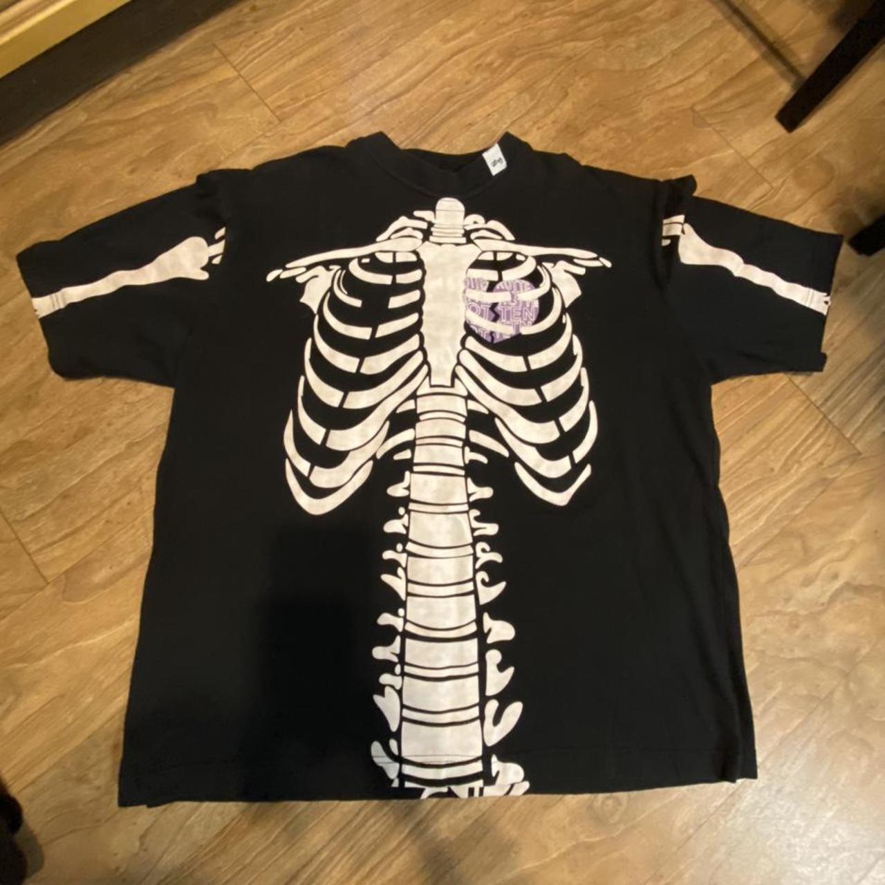lrg skeleton