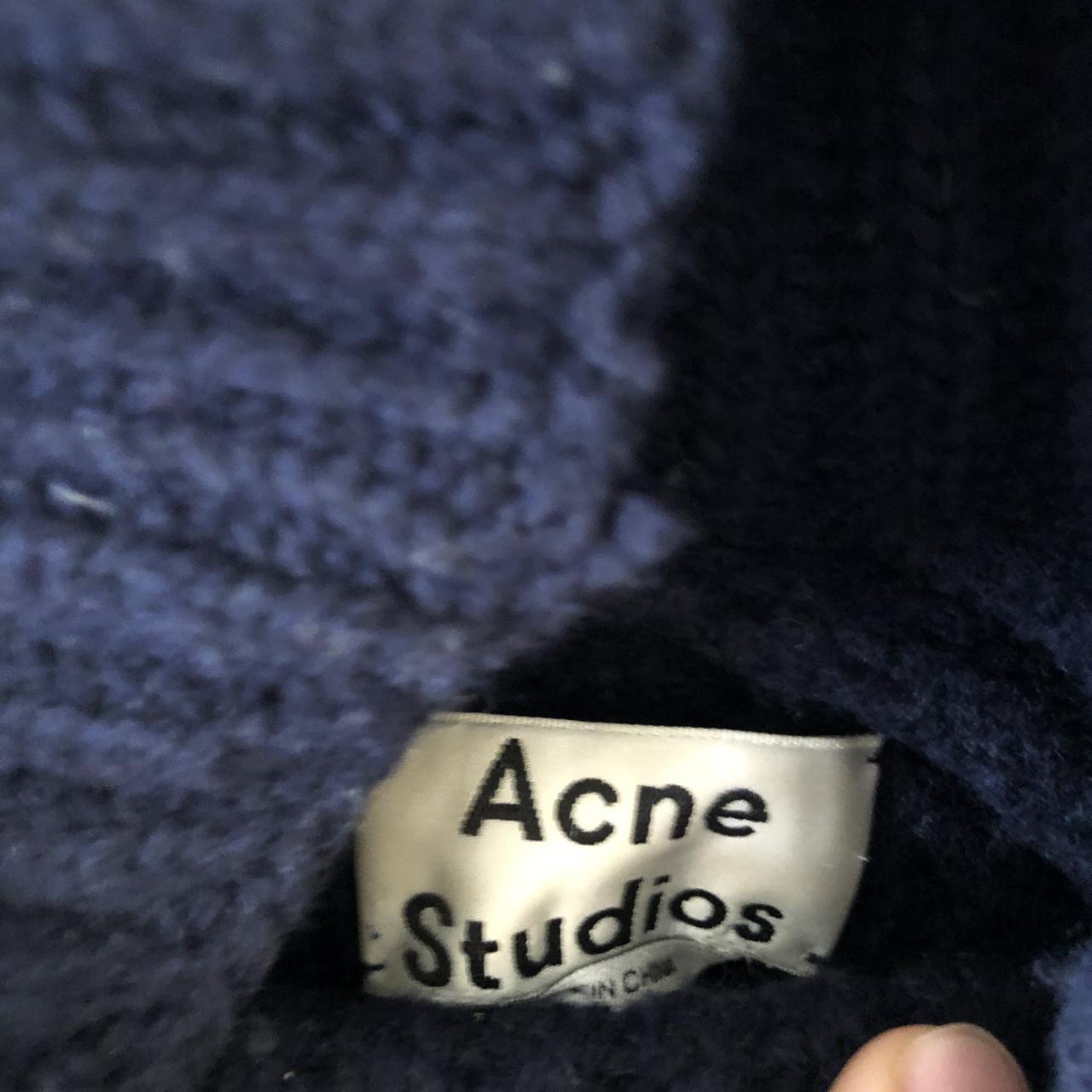 Acne nalle sale